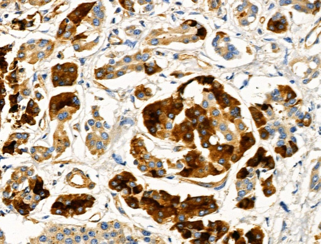 CCS Antibody in Immunohistochemistry (Paraffin) (IHC (P))