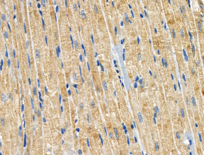 CCS Antibody in Immunohistochemistry (Paraffin) (IHC (P))