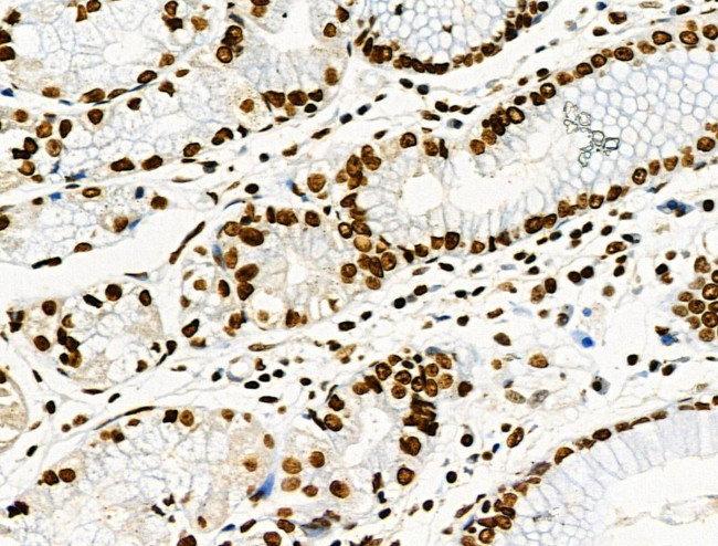 Phospho-CD227 (Mucin 1) (Tyr1229) Antibody in Immunohistochemistry (Paraffin) (IHC (P))