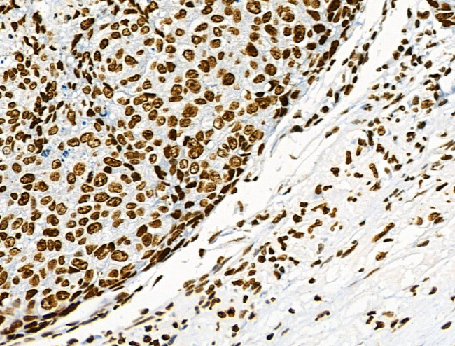 Phospho-CD227 (Mucin 1) (Tyr1229) Antibody in Immunohistochemistry (Paraffin) (IHC (P))