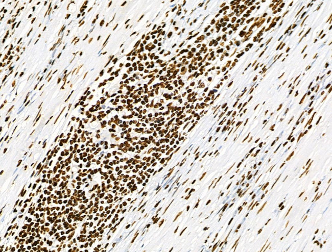 Phospho-CD227 (Mucin 1) (Tyr1229) Antibody in Immunohistochemistry (Paraffin) (IHC (P))