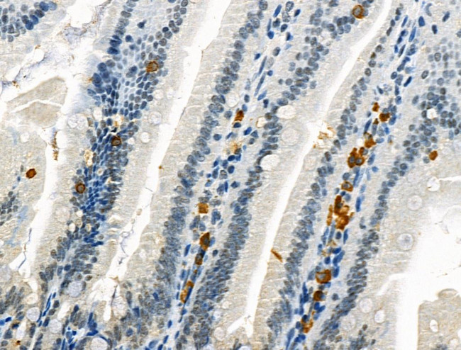 Phospho-CD227 (Mucin 1) (Tyr1229) Antibody in Immunohistochemistry (Paraffin) (IHC (P))