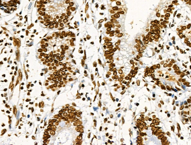 Phospho-CD227 (Mucin 1) (Tyr1229) Antibody in Immunohistochemistry (Paraffin) (IHC (P))