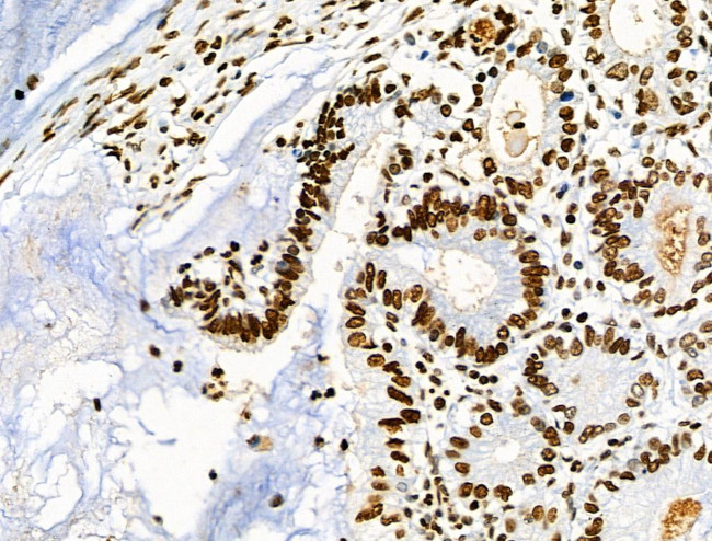 Phospho-CD227 (Mucin 1) (Tyr1229) Antibody in Immunohistochemistry (Paraffin) (IHC (P))