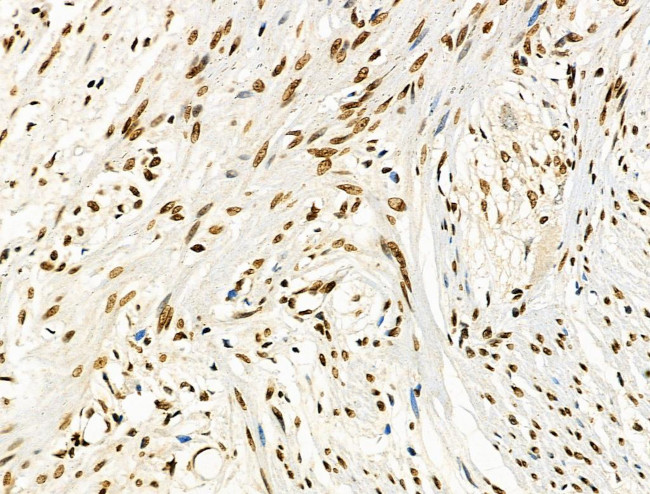 Phospho-CD227 (Mucin 1) (Tyr1229) Antibody in Immunohistochemistry (Paraffin) (IHC (P))