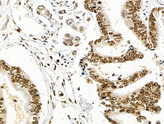 Phospho-CD227 (Mucin 1) (Tyr1229) Antibody in Immunohistochemistry (Paraffin) (IHC (P))