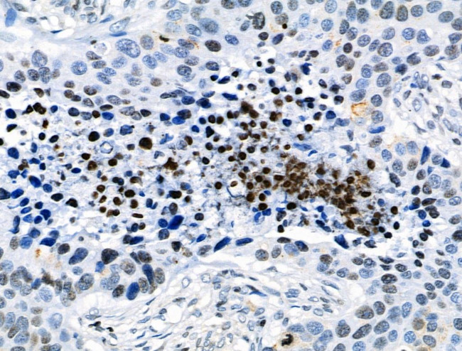 Phospho-CD227 (Mucin 1) (Tyr1229) Antibody in Immunohistochemistry (Paraffin) (IHC (P))