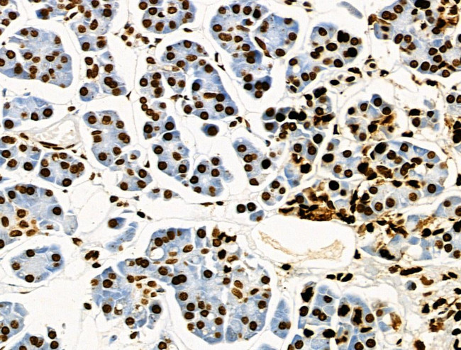 Phospho-CD227 (Mucin 1) (Tyr1229) Antibody in Immunohistochemistry (Paraffin) (IHC (P))