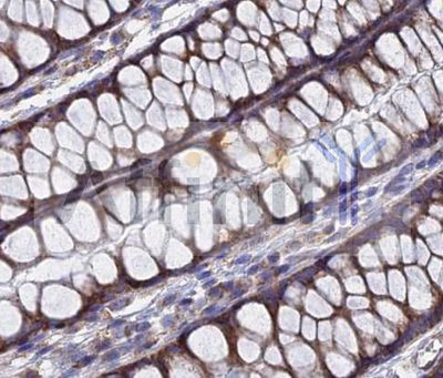 TGF alpha Antibody in Immunohistochemistry (Paraffin) (IHC (P))