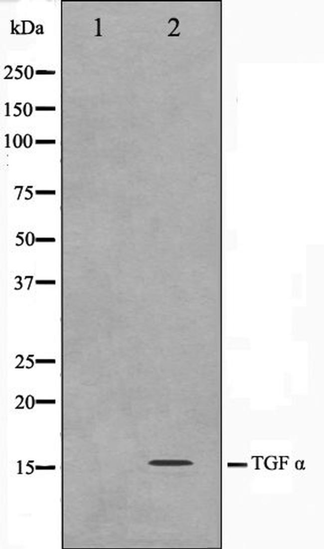 TGF alpha Antibody in Western Blot (WB)