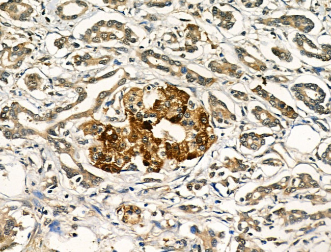 TGF alpha Antibody in Immunohistochemistry (Paraffin) (IHC (P))