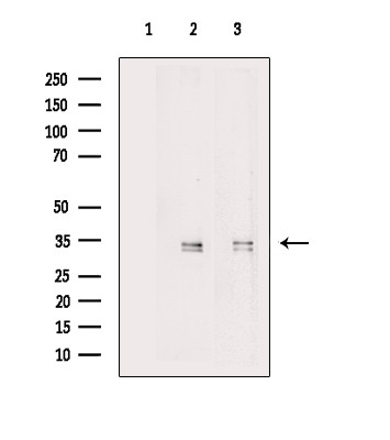 MBD3 Antibody in Western Blot (WB)