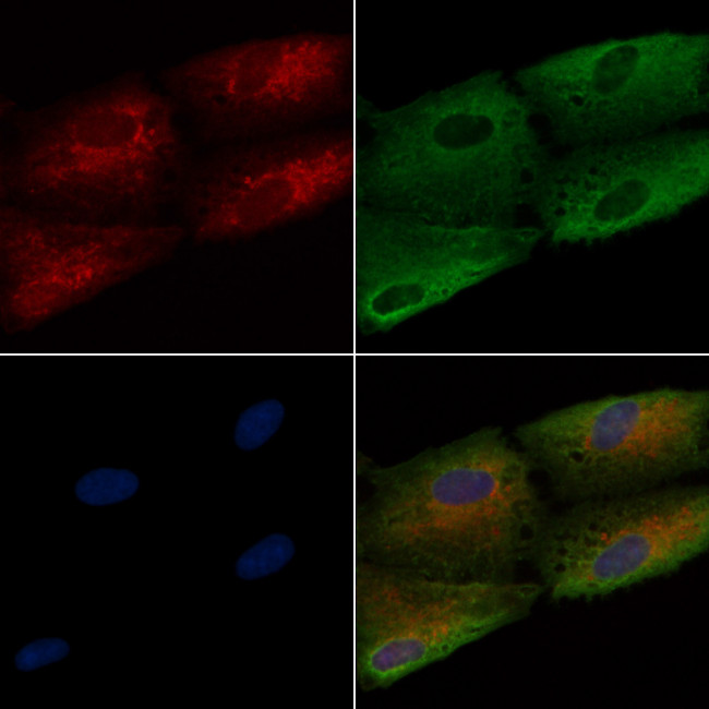 TNFAIP8 Antibody in Immunocytochemistry (ICC/IF)