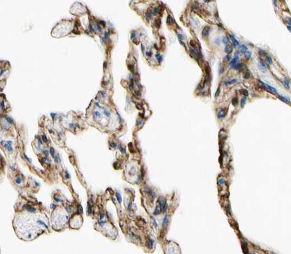 TNFAIP8 Antibody in Immunohistochemistry (Paraffin) (IHC (P))