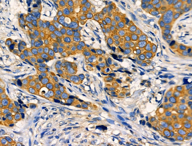 TNFAIP8 Antibody in Immunohistochemistry (Paraffin) (IHC (P))