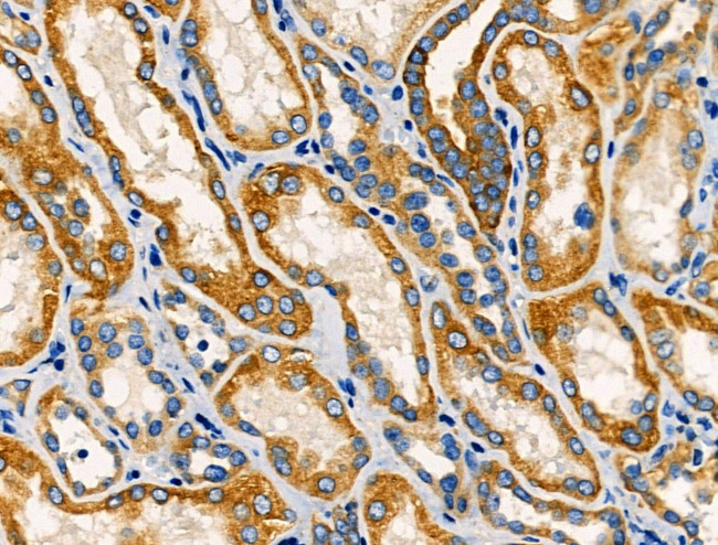 TNFAIP8 Antibody in Immunohistochemistry (Paraffin) (IHC (P))