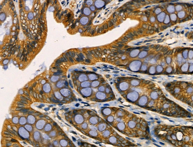 TNFAIP8 Antibody in Immunohistochemistry (Paraffin) (IHC (P))