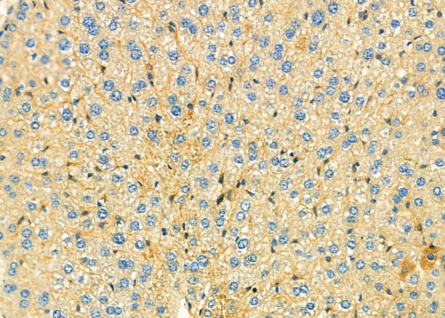 GCP3 Antibody in Immunohistochemistry (Paraffin) (IHC (P))