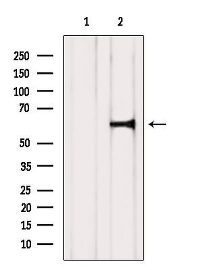 ADCK1 Antibody in Western Blot (WB)