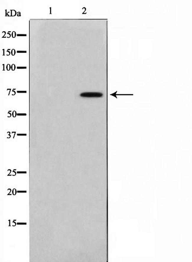 TAF6L Antibody in Western Blot (WB)