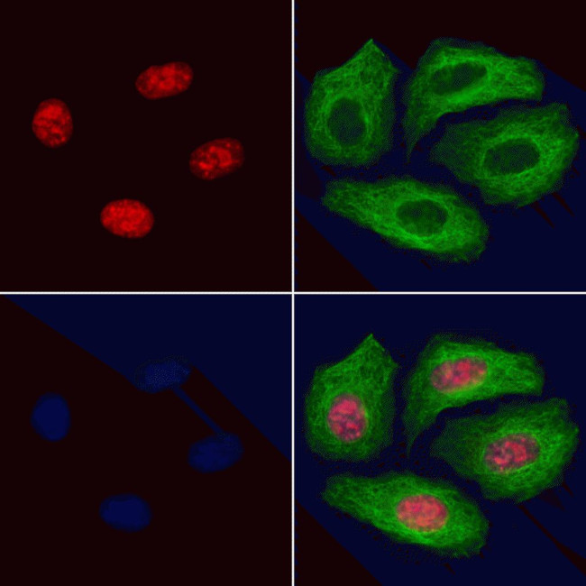 Phospho-GATA1 (Ser310) Antibody in Immunocytochemistry (ICC/IF)