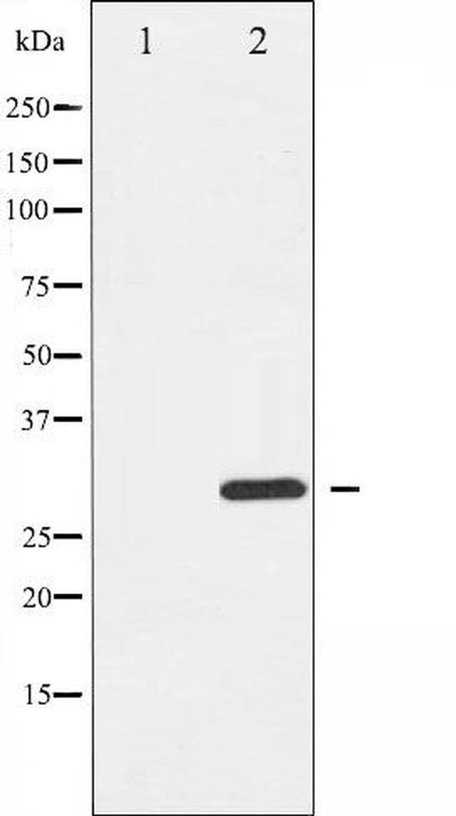 Phospho-BIK (Thr33) Antibody in Western Blot (WB)