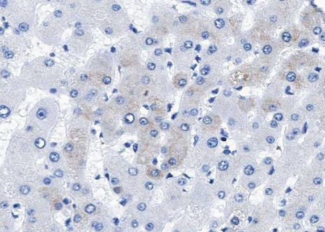 BMP-5 Antibody in Immunohistochemistry (Paraffin) (IHC (P))