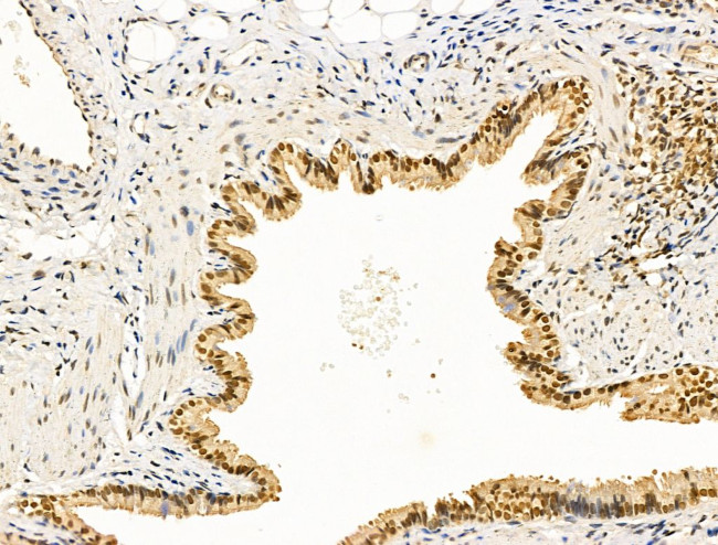 Cyclin A Antibody in Immunohistochemistry (Paraffin) (IHC (P))