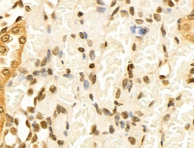 Cyclin A Antibody in Immunohistochemistry (Paraffin) (IHC (P))