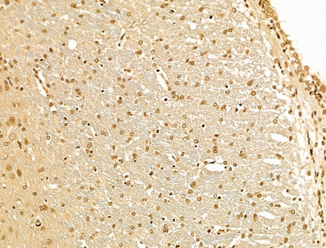 Cyclin A Antibody in Immunohistochemistry (Paraffin) (IHC (P))