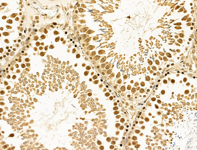 Cyclin A Antibody in Immunohistochemistry (Paraffin) (IHC (P))