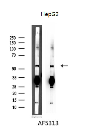 Cyclin A Antibody in Western Blot (WB)