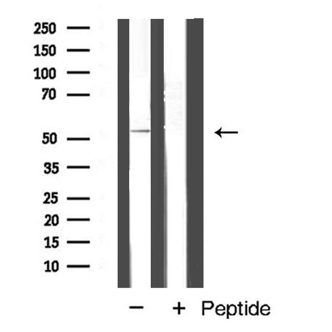 Cyclin A Antibody in Western Blot (WB)