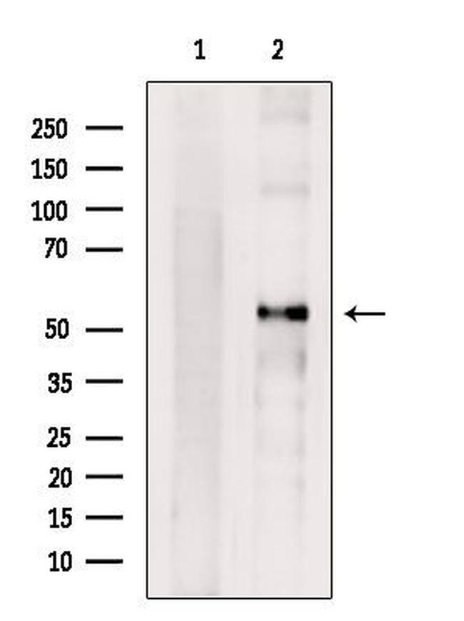 Cyclin A Antibody in Western Blot (WB)