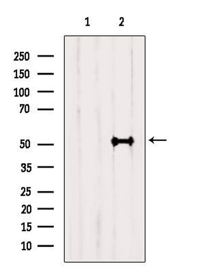 Cyclin A Antibody in Western Blot (WB)