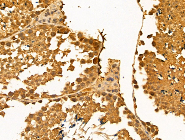 HSPH1 Antibody in Immunohistochemistry (Paraffin) (IHC (P))