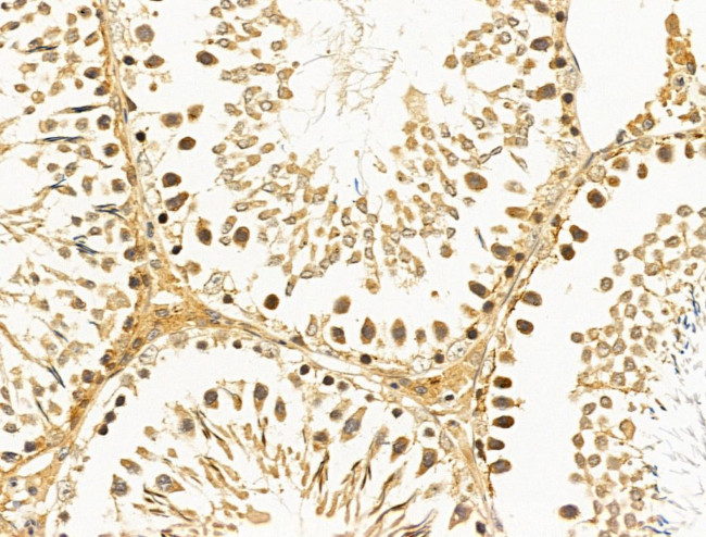 HSPH1 Antibody in Immunohistochemistry (Paraffin) (IHC (P))