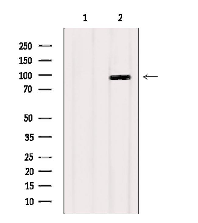 HSPH1 Antibody in Western Blot (WB)