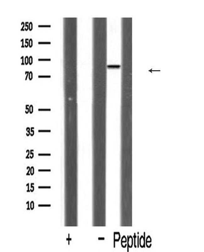 HSPH1 Antibody in Western Blot (WB)