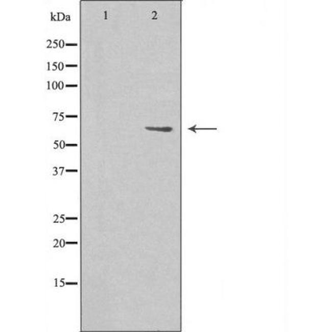 MARCKS Antibody in Western Blot (WB)