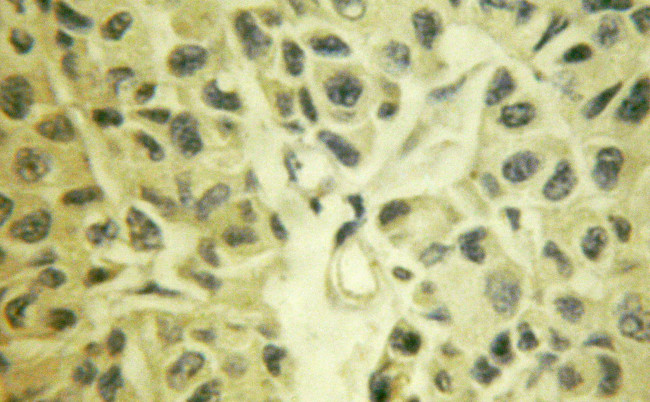 TAK1 Antibody in Immunohistochemistry (Paraffin) (IHC (P))