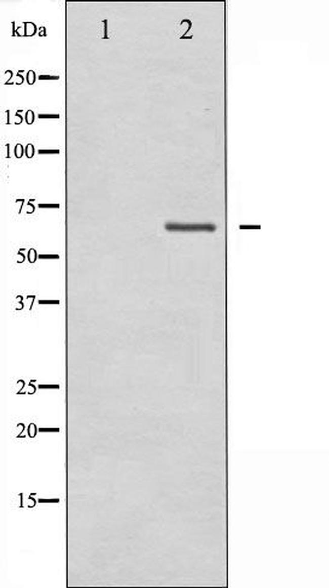 TAK1 Antibody in Western Blot (WB)