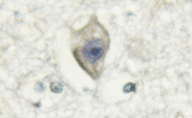 Calmodulin 1/2/3 Antibody in Immunohistochemistry (Paraffin) (IHC (P))