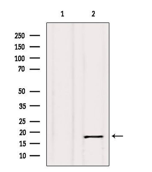 Calmodulin 1/2/3 Antibody in Western Blot (WB)