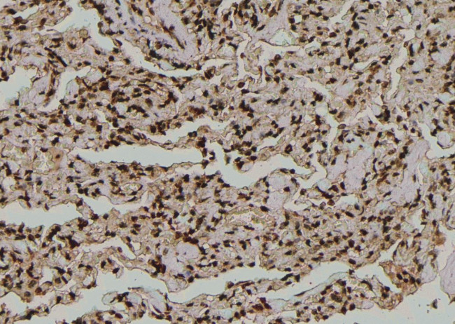 Phospho-SF1 (Ser80, Ser82) Antibody in Immunohistochemistry (Paraffin) (IHC (P))