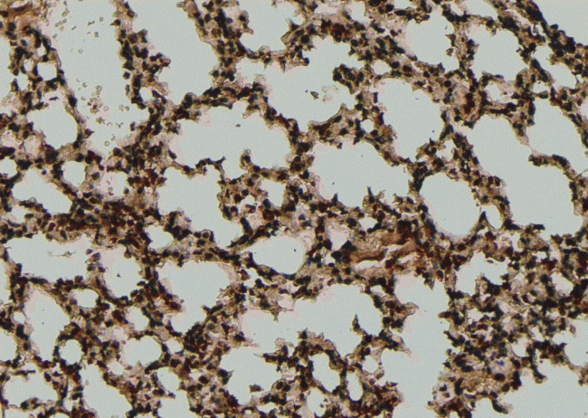 Phospho-SF1 (Ser80, Ser82) Antibody in Immunohistochemistry (Paraffin) (IHC (P))