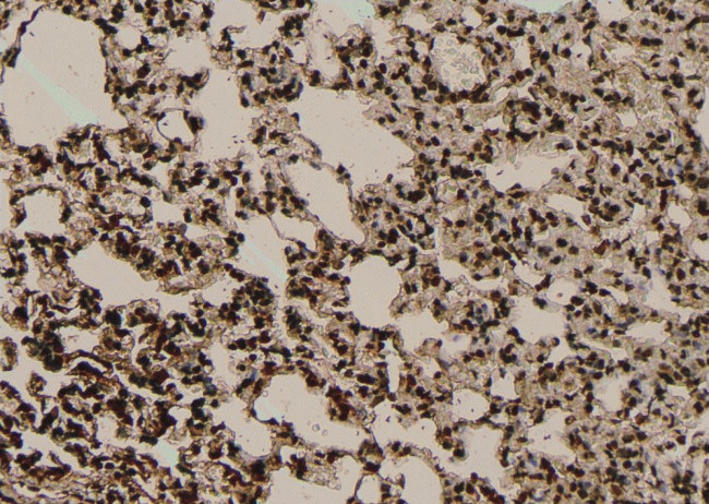 Phospho-SF1 (Ser80, Ser82) Antibody in Immunohistochemistry (Paraffin) (IHC (P))