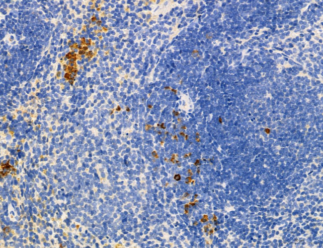 Phospho-MYL2 (Ser15) Antibody in Immunohistochemistry (Paraffin) (IHC (P))