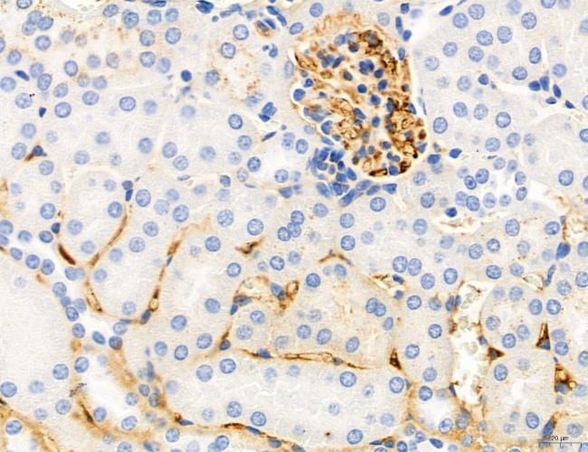 Phospho-MYL2 (Ser15) Antibody in Immunohistochemistry (Paraffin) (IHC (P))