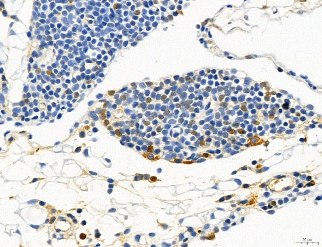 Phospho-MYL2 (Ser15) Antibody in Immunohistochemistry (Paraffin) (IHC (P))